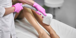 Лазерна епіляція